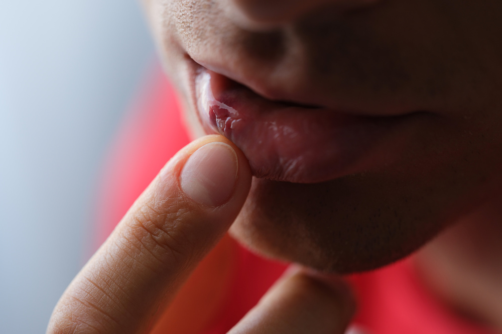Oral Health and Facial Pathology | Williams Surgical Arts