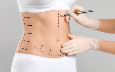 The Most Popular Plastic Surgery Procedures for 2025